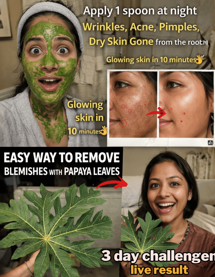 Forget Everything Else: This Papaya Leaf Hack Is Seriously Fading Melasma, Pigmentation, & Discoloration – Naturally!