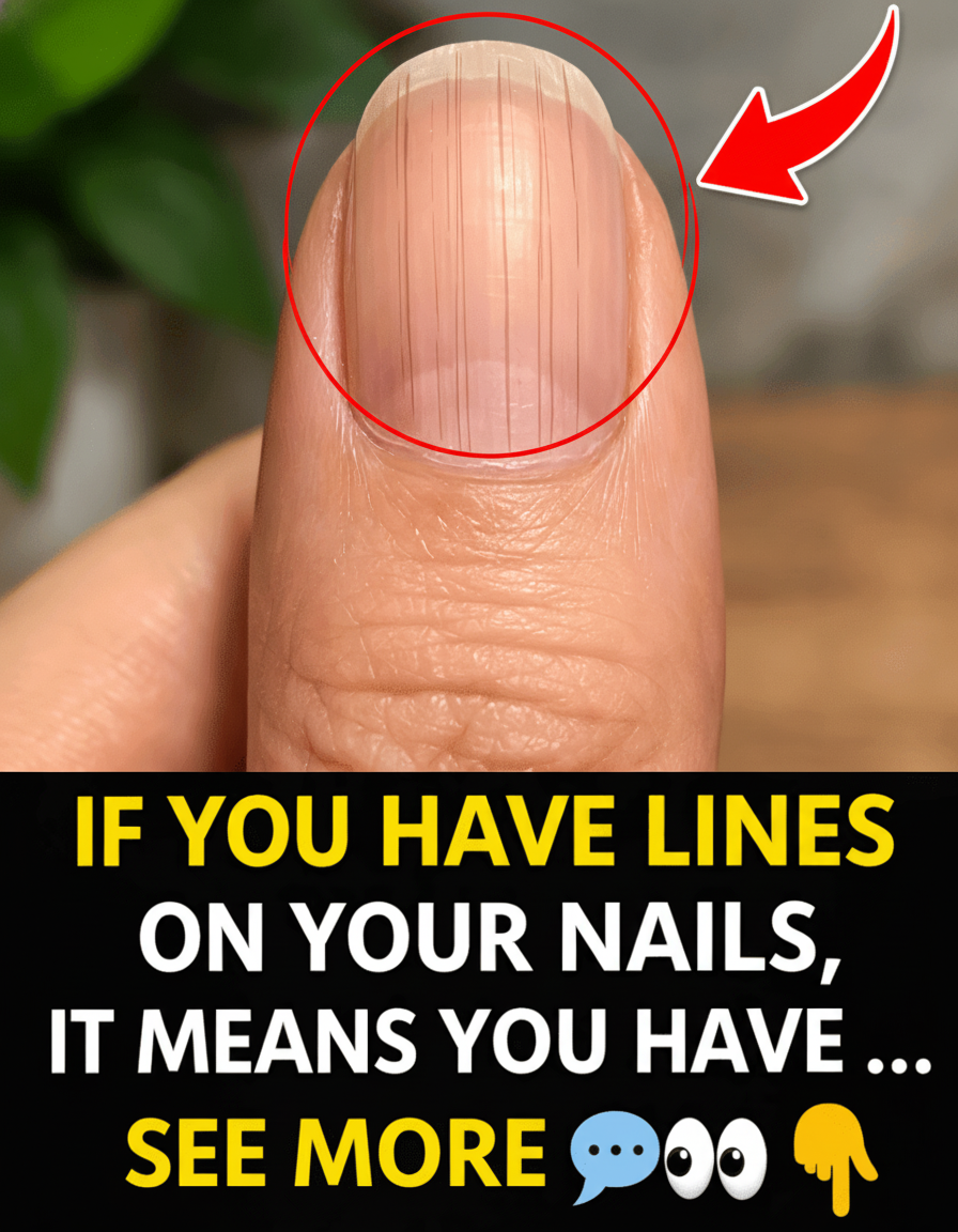 Fingernail Lines: What They're REALLY Screaming About Your Health (And How to Shut 'Em Up with Killer Habits!)