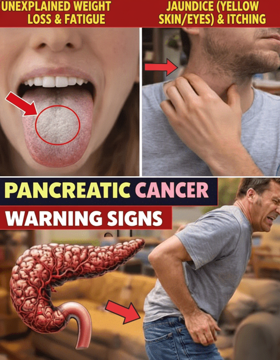 Don't Get Played: 12 Early Pancreatic Cancer Signs Older Adults *Absolutely* Cannot Brush Off