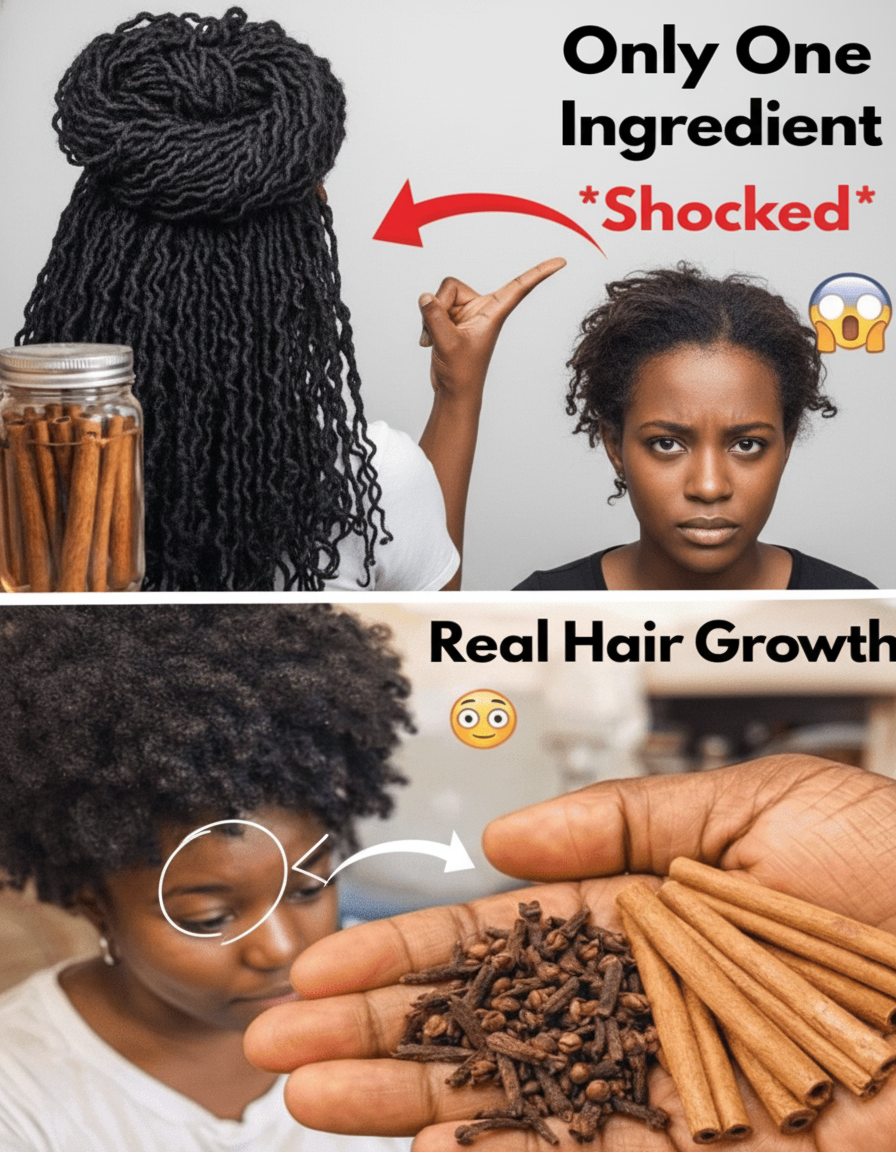 Tired of Thinning Strands? Cloves & Cinnamon: The Fiery Hair Growth Hack You NEED to Know!