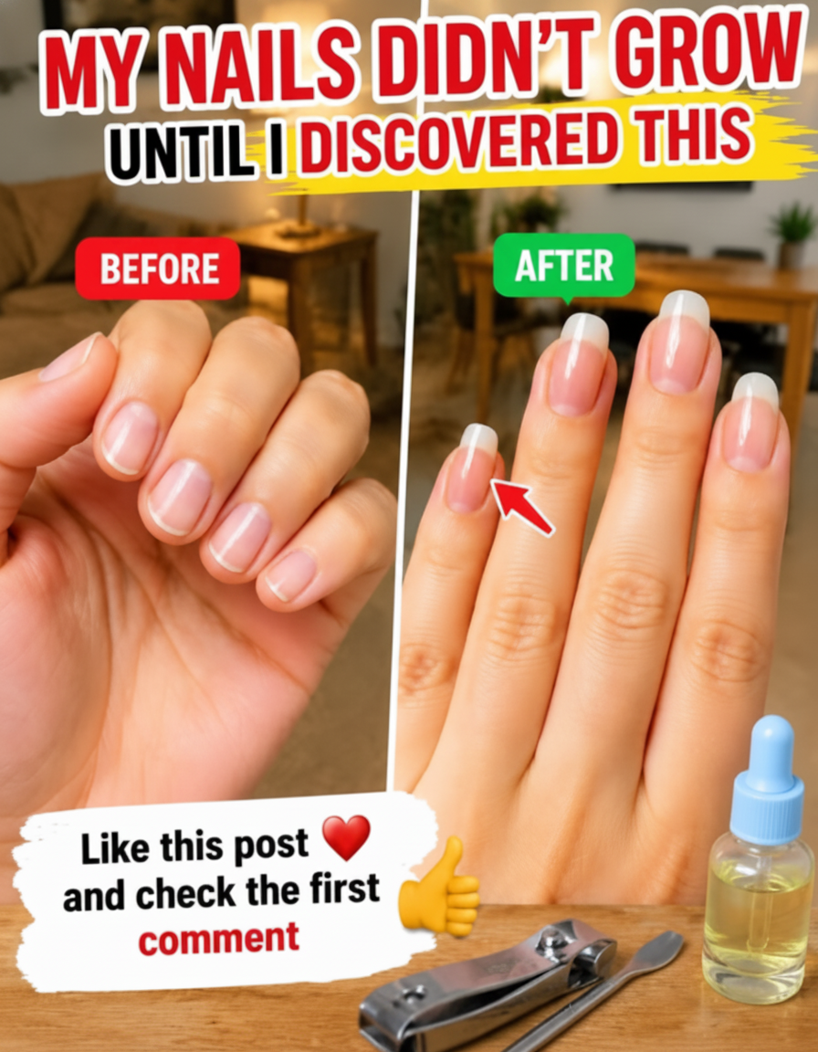 Nails Cracking After 50? Here's the REAL Talk & Daily Hacks to Get 'Em Strong!